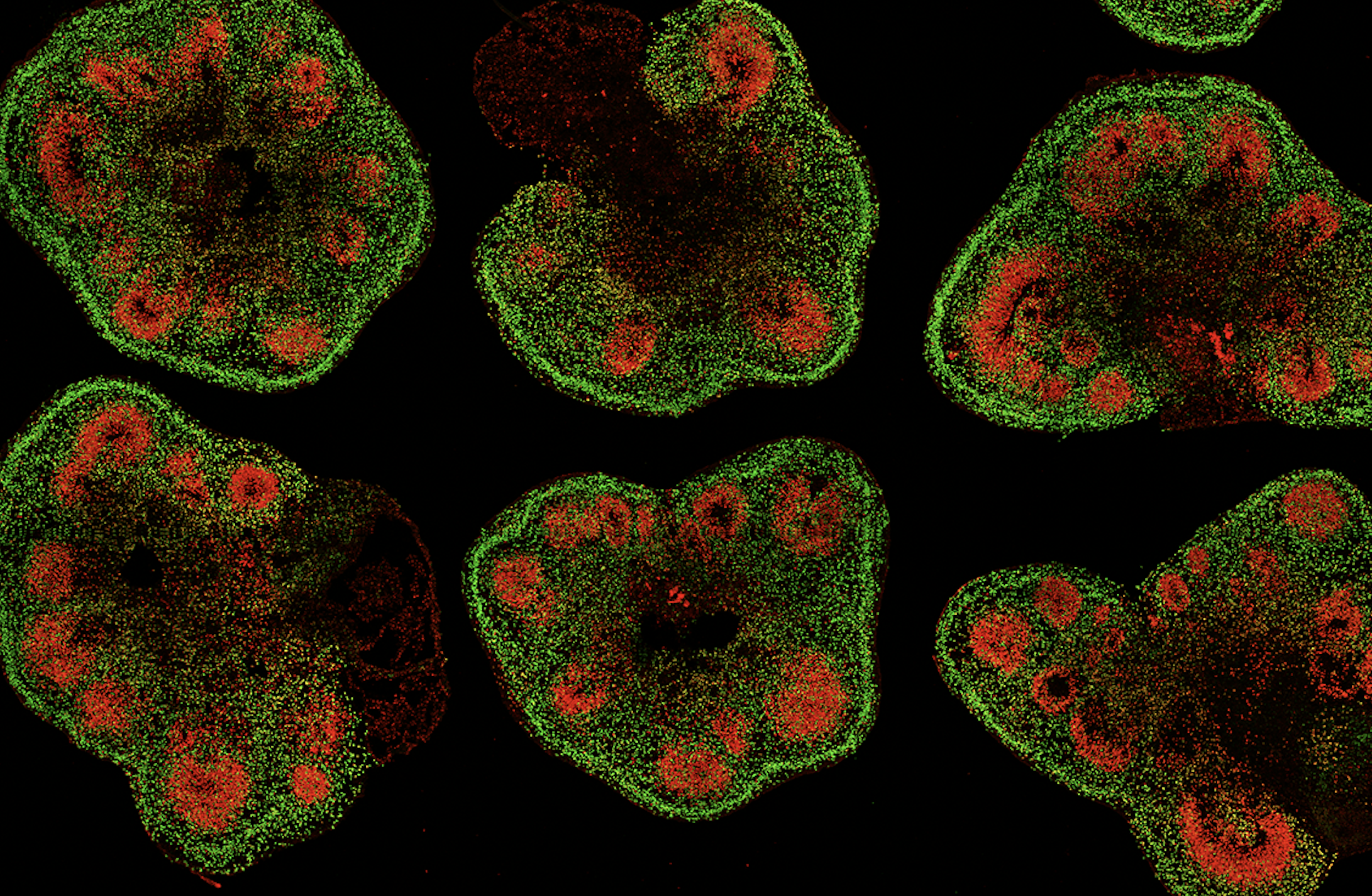 brain organoids traumatic injury treatment